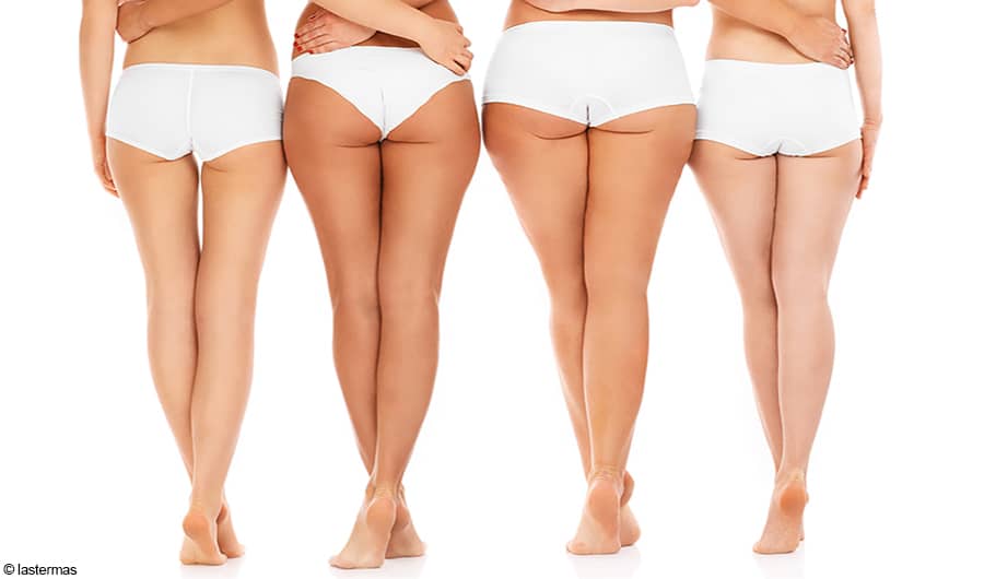 causes of cellulite 